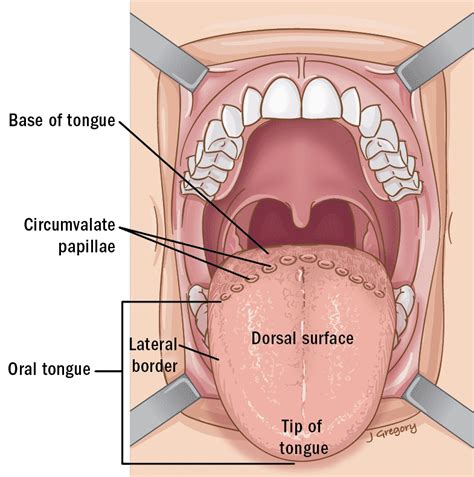 Tongue Cancer ‣ Anatomy ‣ THANC Guide