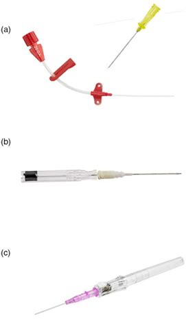 Arterial line insertion - Armstrong - 2023 - Emergency Medicine ...