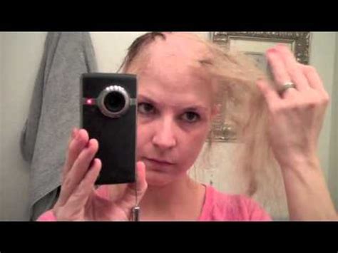 Road to bald-dom (Last 5 days of Chemo hair loss Process) - YouTube