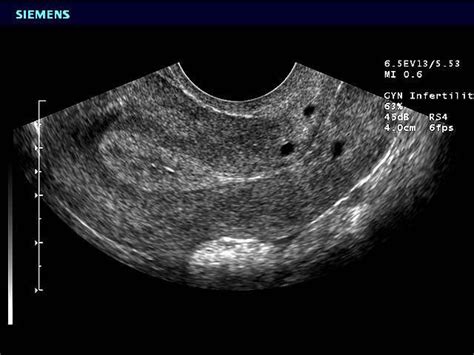 Pin on Medical ultrasound