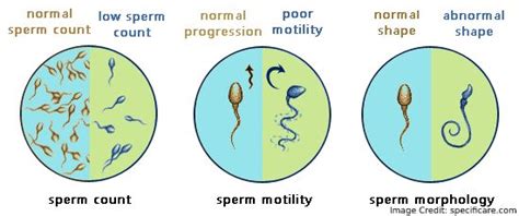 Asthenozoospermia: Symptoms, Causes, Treatments and More