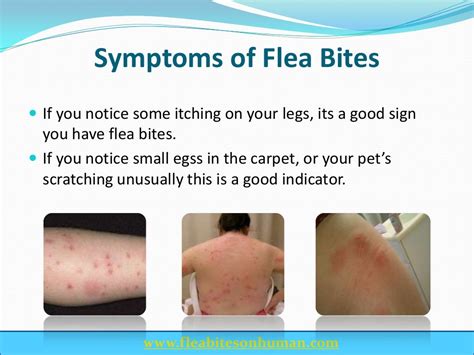 Flea bites on human