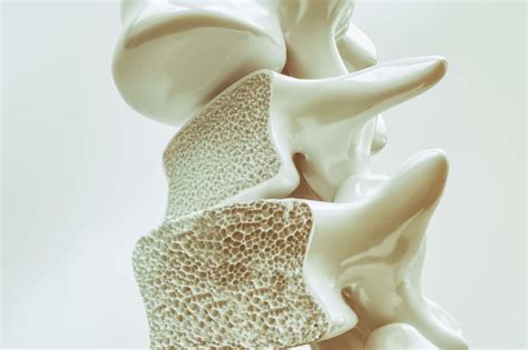 What is a Bone Scan and Why is It Important?