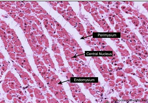 Cardiac-Muscle-Cross-section-slide-labelled-histology | Online Homework ...