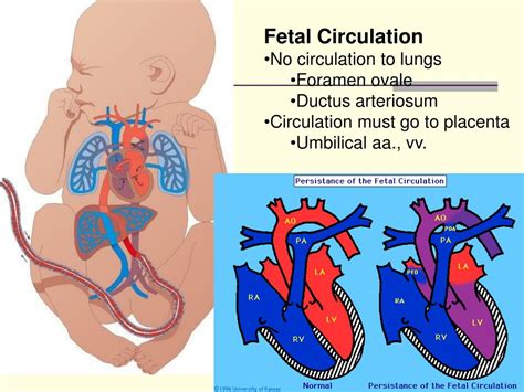 Fetal Circulation Pda - Image to u