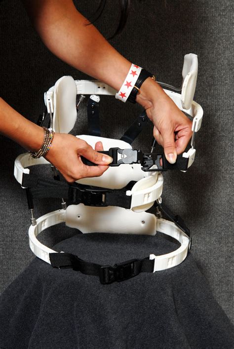 What Is a Dynamic Scoliosis Brace and How It Helps