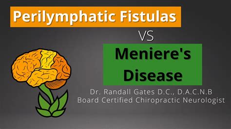 Perilymphatic Fistulas vs Meniere's Disease - YouTube