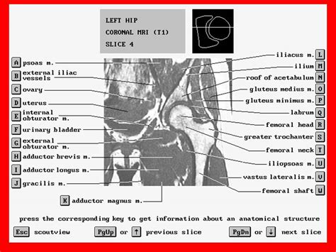 Pelvis Muscles Mri Anatomy : MRI HIP JIONT ANATOMY Dr/AHMED EISAWY ...