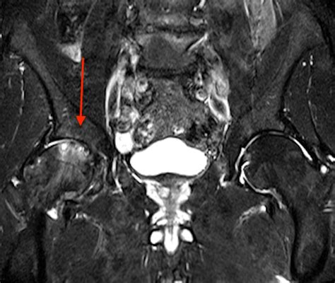 The Telltale Bone | Neighborhood Radiologist