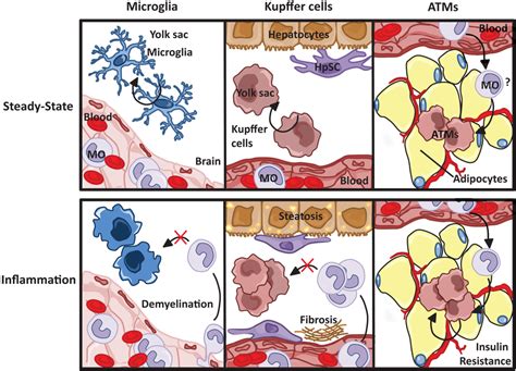 The dual role of M1/M2 Kupffer cells in NAFLD. Kupffer cells play a ...