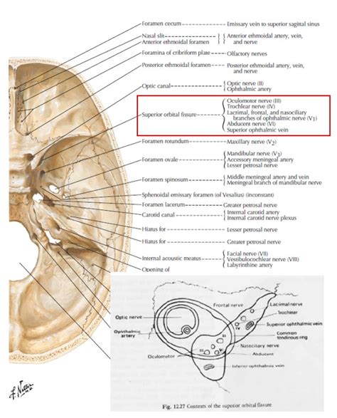 Superior Orbital Fissure Syndrome VS Orbital Apex Syndrome - Dr. Paul ...