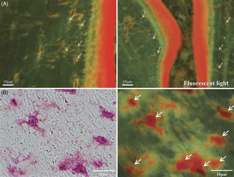 (A) Osteocyte canaliculi after total parathyroidectomy (PTX) in group ...