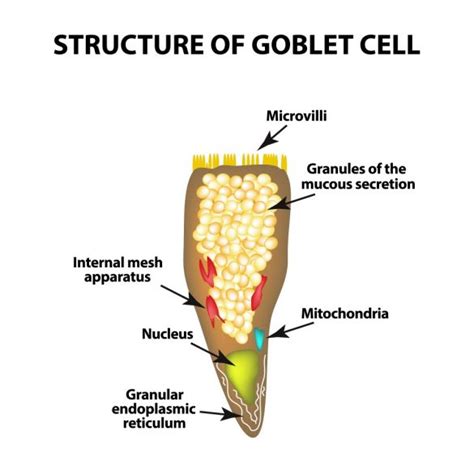 Goblet Cell Adenocarcinoma - Symptoms, Causes, Treatment Options