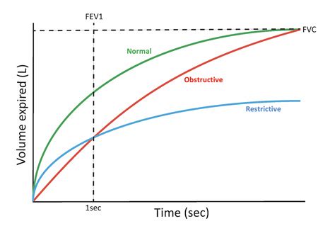 Spirometry | OSCEstop | OSCE Learning