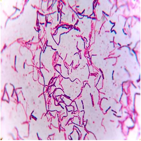 Bacillus Cereus Gram Stain