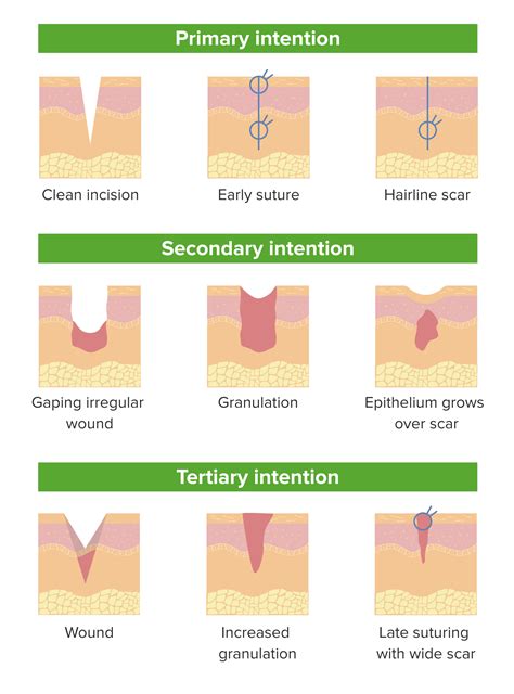 Wound Healing Before And After