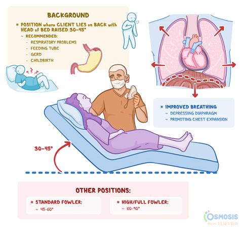 Semi-Fowler Position: What Is It | Osmosis