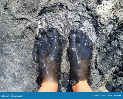 Therapeutic Mud. Mud Foot Treatment. Arthritis and Arthrosis Treatment ...