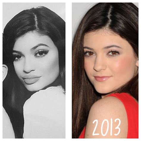 Kylie jenner plastic surgery before and after images the teal mango ...