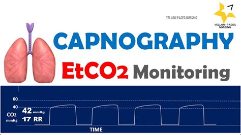 Capnography | ETCO2 Monitoring - YouTube