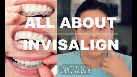 INVISALIGN REVIEW | HOW IT WORKS AND WHAT TO EXPECT - YouTube