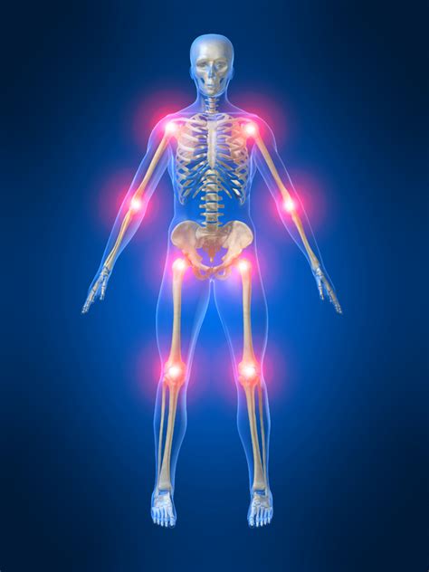 Causes For Severe Joint And Muscle Pain at Adelle Hardy blog