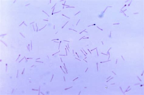 Free picture: clostridium cell, genus, anaerobic, spore, forming, bacteria