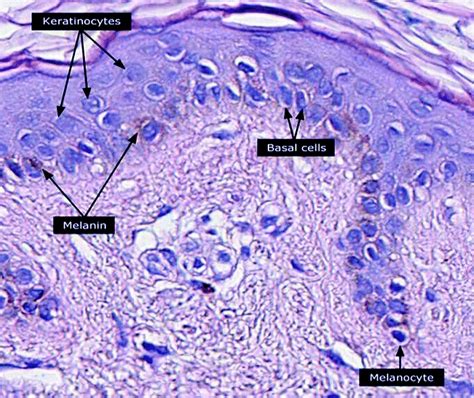 Keratinocyte