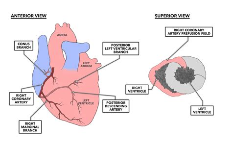 CrossFit | The Heart, Part 7: Coronary Circulation