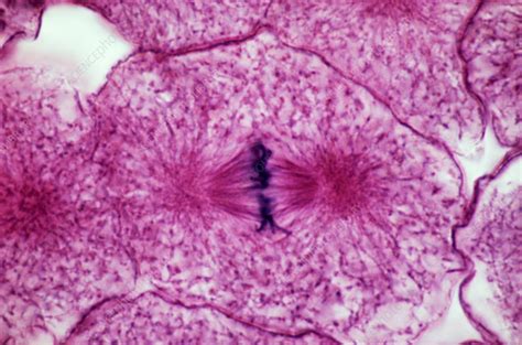 Metaphase Of Mitosis