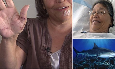 Hawaii tiger shark attack: Retired teacher Evonne Cashman, 56, shows ...