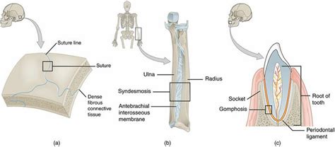 Intervertebral Joint Structural Classification