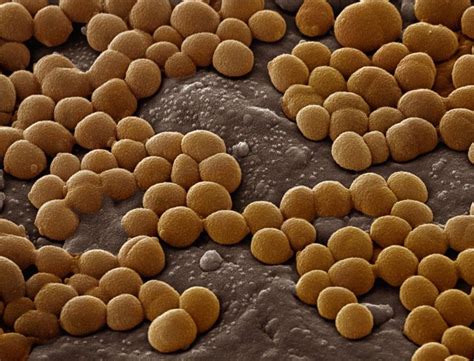 Cocci - spherical bacteria bacteria Cocci | Unwanted guests | Pinterest ...