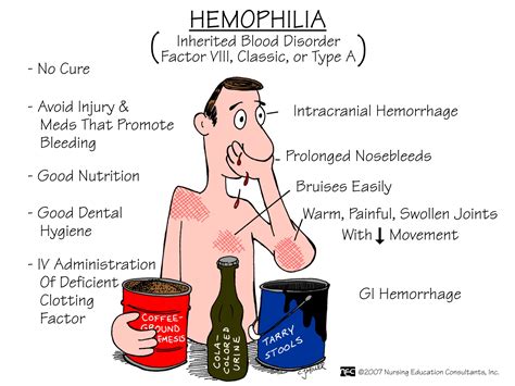 Nursing School: Medical Surgical Nursing Mnemonics