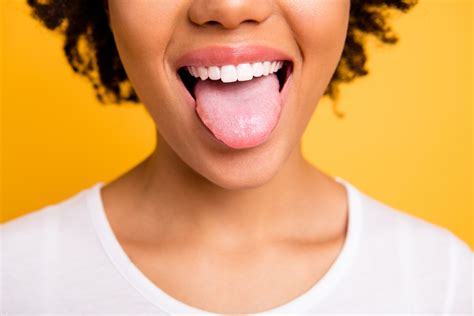 Geographic Tongue Causes, Symptoms, & Treatment | CariFree