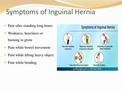 PPT - Inguinal Hernia Types, Symptoms, Diagnosis & Treatments ...