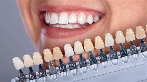 Can Teeth Whitening Cause Receding Gums? | Smile Stories