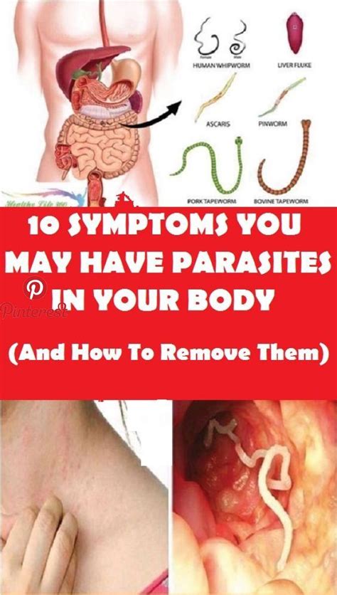 10 Symptoms You May Have Parasites in your Body (And How To Remove Them ...