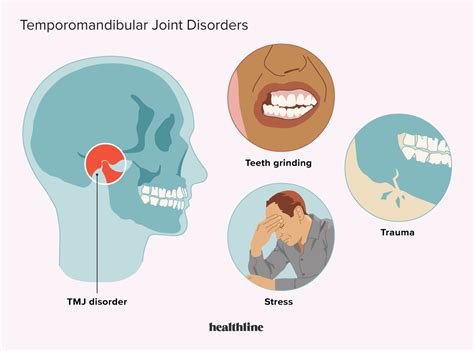 TMJ (Temporomandibular Joint) Disorders: Symptoms and More