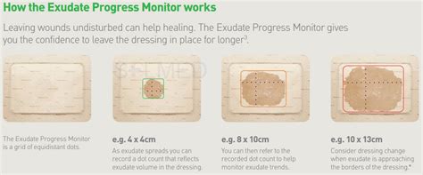 Mepilex Border Flex | SOLMED MEDICAL SUPPLIES – Solmed Medical Supplies