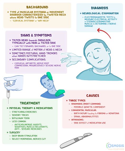 Torticollis: What Is It, Causes, and More | Osmosis