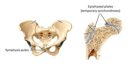 Identify each of the following using the pictures below. *Synchondrosis ...