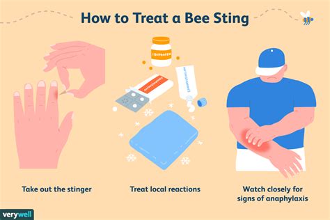 Bee Sting Self-Care: Treatment, Prevention, and More