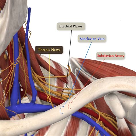 Pdf Lateral Approach For Supraclavicular Brachial Plexus Block | Porn ...