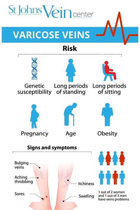 Varicose Veins 101 - A Guide to Varicose Vein Symptoms and Treatment ...