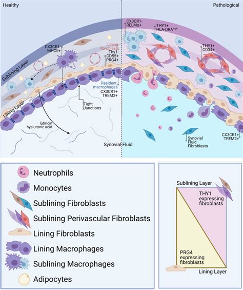 Synovial structure in health and disease. The healthy synovium consists ...