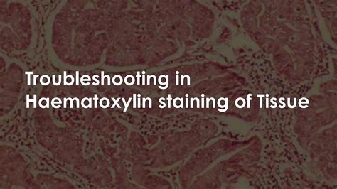 SOLUTION: Troubleshooting in haematoxylin staining - Studypool