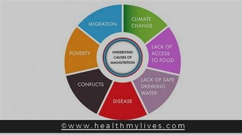 MALNUTRITION - Symptoms, Causes, Preventions And Treatments