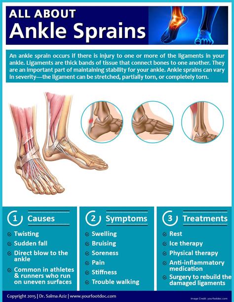 Diagram Of Sprained Ankle