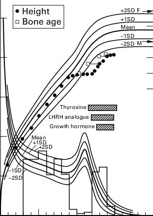 Treatment, bone age, and height of the patient, plotted on a cross ...